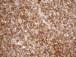 LIMA1 Antibody in Immunohistochemistry (Paraffin) (IHC (P))