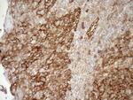 LIMA1 Antibody in Immunohistochemistry (Paraffin) (IHC (P))