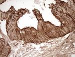 LIMA1 Antibody in Immunohistochemistry (Paraffin) (IHC (P))