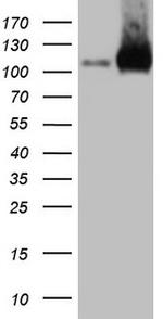 LIMA1 Antibody in Western Blot (WB)
