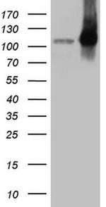 LIMA1 Antibody in Western Blot (WB)