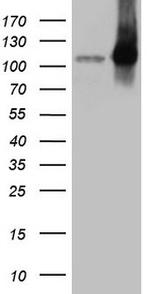 LIMA1 Antibody in Western Blot (WB)