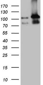 LIMA1 Antibody in Western Blot (WB)