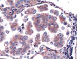 LIMD1 Antibody in Immunohistochemistry (IHC)