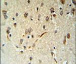 LIMD2 Antibody in Immunohistochemistry (IHC)