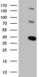 LIME1 Antibody in Western Blot (WB)