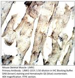 LIMK1 Polyclonal Antibody