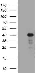 LIMS2 Antibody in Western Blot (WB)