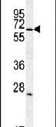 LINGO1 Antibody in Western Blot (WB)