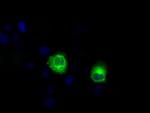 LIPG Antibody in Immunocytochemistry (ICC/IF)