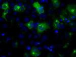 LIPG Antibody in Immunocytochemistry (ICC/IF)