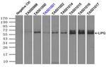 LIPG Antibody in Immunoprecipitation (IP)