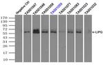 LIPG Antibody in Immunoprecipitation (IP)