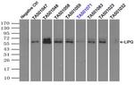 LIPG Antibody in Immunoprecipitation (IP)
