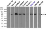LIPG Antibody in Immunoprecipitation (IP)