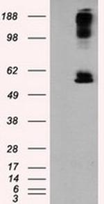 LIPG Antibody in Western Blot (WB)