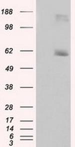 LIPG Antibody in Western Blot (WB)