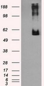LIPG Antibody in Western Blot (WB)