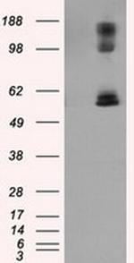 LIPG Antibody in Western Blot (WB)
