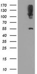 LIPG Antibody in Western Blot (WB)