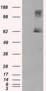 LIPG Antibody in Western Blot (WB)