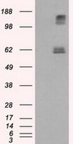 LIPG Antibody in Western Blot (WB)