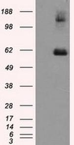 LIPG Antibody in Western Blot (WB)