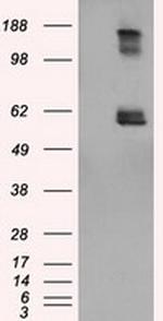 LIPG Antibody in Western Blot (WB)