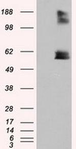 LIPG Antibody in Western Blot (WB)