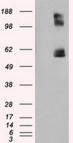 LIPG Antibody in Western Blot (WB)