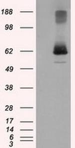 LIPG Antibody in Western Blot (WB)