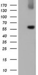 LIPG Antibody in Western Blot (WB)