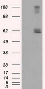 LIPG Antibody in Western Blot (WB)