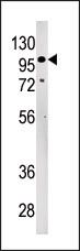 LLGL2 Antibody in Western Blot (WB)