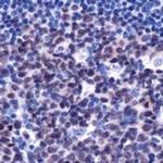 LMO2 Antibody in Immunohistochemistry (IHC)