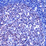 LMO2 Polyclonal Antibody