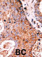 LMTK2 Antibody in Immunohistochemistry (IHC)