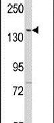 LMTK2 Antibody in Western Blot (WB)