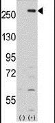 LMTK2 Antibody in Western Blot (WB)