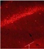 Glycine Binding Protein Antibody in Immunohistochemistry (IHC)