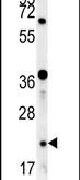 LOH12CR1 Antibody in Western Blot (WB)