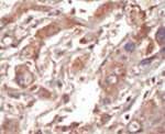 LOK Antibody in Immunohistochemistry (IHC)