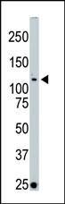 LOK Antibody in Western Blot (WB)