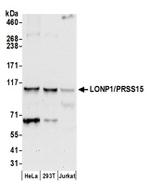 LONP1/PRSS15 Antibody in Western Blot (WB)