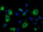 LOX Antibody in Immunocytochemistry (ICC/IF)