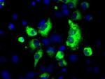 LOX Antibody in Immunocytochemistry (ICC/IF)
