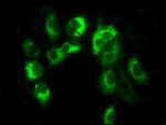 LOX Antibody in Immunocytochemistry (ICC/IF)