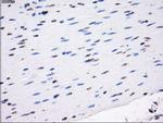 LOX Antibody in Immunohistochemistry (Paraffin) (IHC (P))