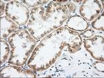 LOX Antibody in Immunohistochemistry (Paraffin) (IHC (P))