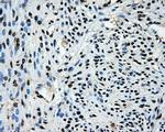 LOX Antibody in Immunohistochemistry (Paraffin) (IHC (P))